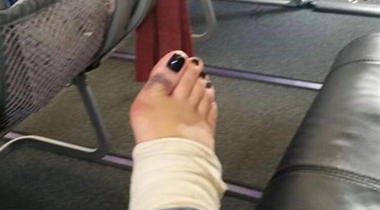 Το ατύχημα ηθοποιού σε κυπριακή σειρά 