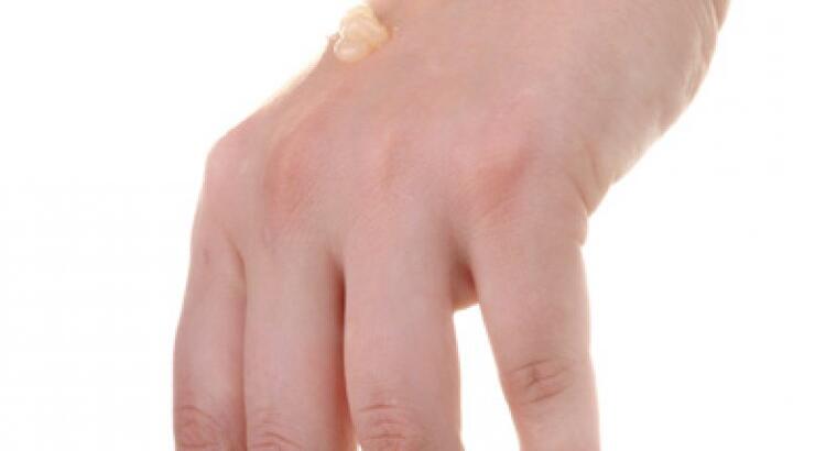 Εξαφανίστε εδώ και τώρα τις κηλίδες από το δέρμα σας 