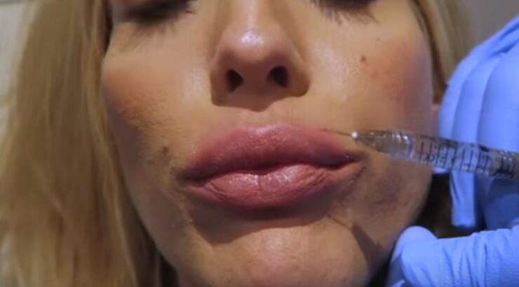 Ελληνίδα παρουσιάστρια φούσκωσε τα χείλη της και μας το έδειξε! [βίντεο]
