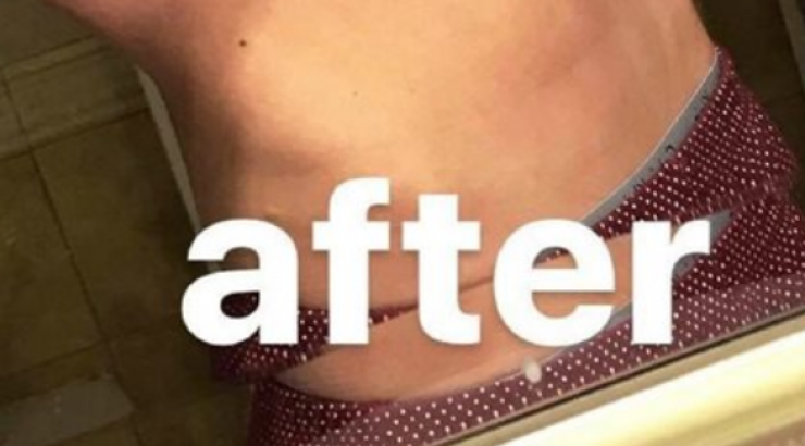 Πάθαμε πλάκα! Αυτό είναι το σώμα επώνυμης Ελληνίδας πέντε μήνες μετά τη γέννηση του μωρού της!