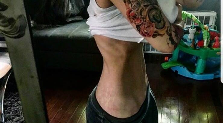 Σοκάρει η σκελετωμένη εικόνα επώνυμης Ελληνίδας