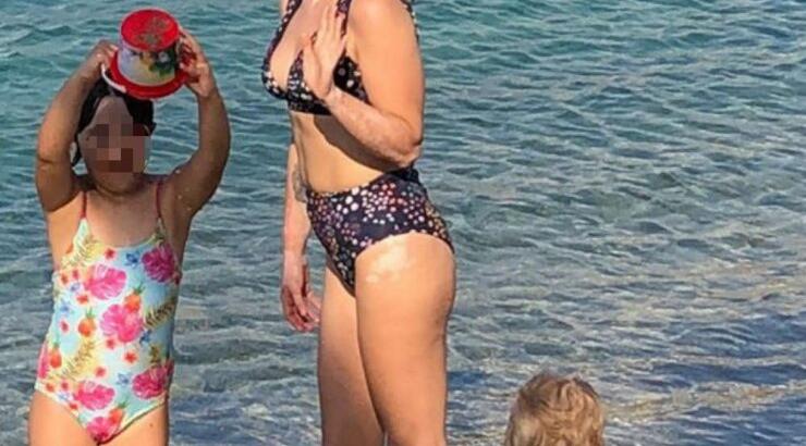 Ελληνίδα παρουσιάστρια φόρεσε μπικίνι και αποκαλύπτει τα σημάδια από τη λεύκη στο σώμα της! 