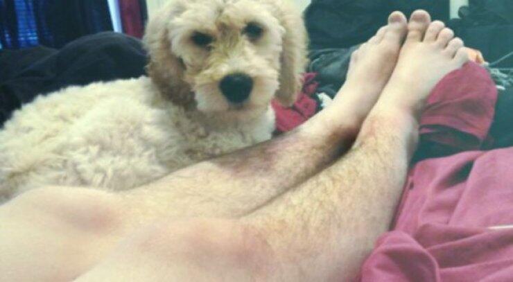 Κι όμως είναι γυναίκες: Το νέο κίνημα για τα αξύριστα πόδια έχει κατακλύσει το διαδίκτυο