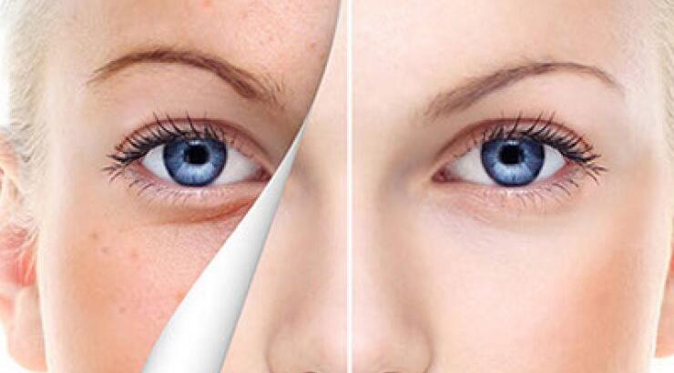 BDR Expert - Σεμινάριο Αισθητικής