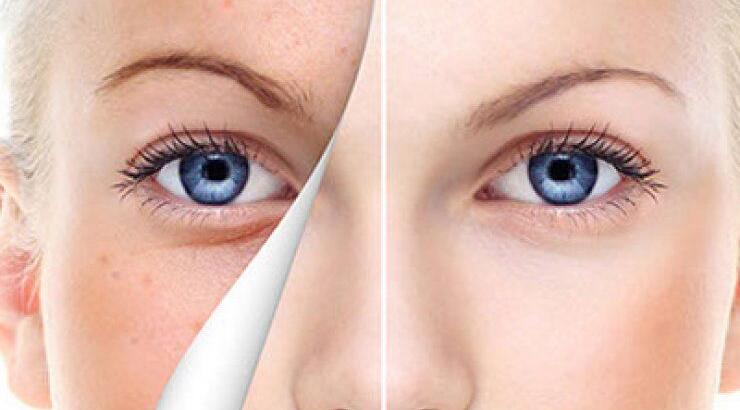 BDR Expert - Σεμινάριο Αισθητικής