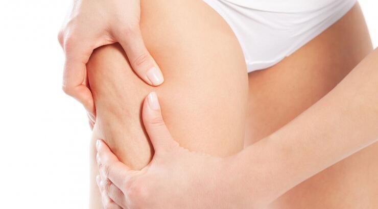 Κυτταρίτιδα...και ποια δεν έχει!