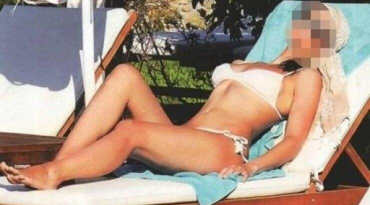 Γνωστή Ελληνίδα δηλώνει: «Έχω και κυτταρίτιδα και χαλάρωση»