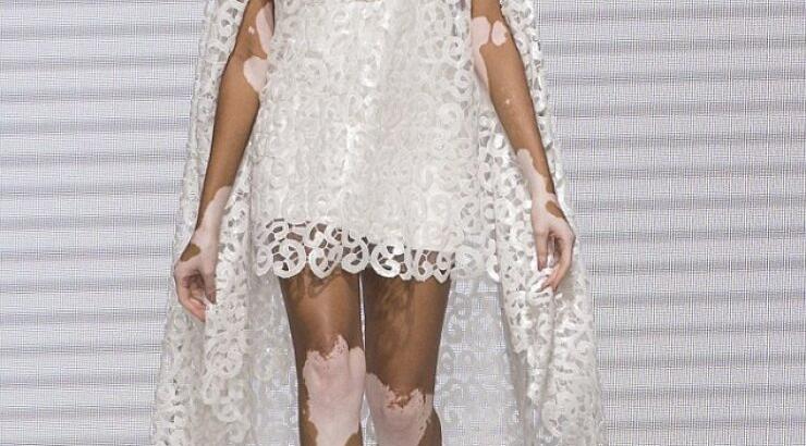 Διαφορετική ομορφιά: Η Winnie Harlow έκλεψε τις εντυπώσεις στην εβδομάδα μόδας στο Παρίσι