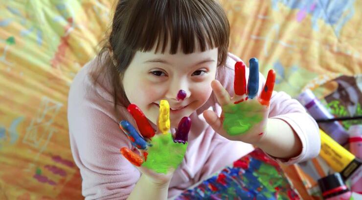 Ανακαλύπτοντας τα παιδιά με Σύνδρομο Down: Όλα όσα πρέπει να γνωρίζετε!