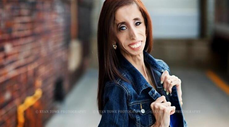 Η ασχημότερη γυναίκα στον κόσμο ενάντια στο bullying 