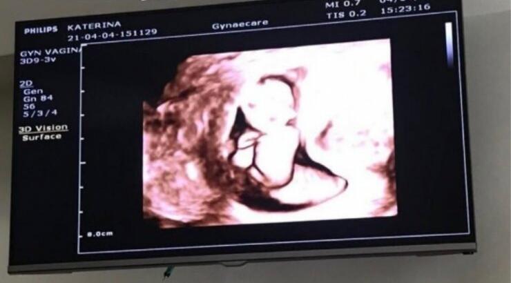 Γνωστός Κύπριος έγινε μπαμπάς τον Οκτώβριο και μόλις το μάθαμε! [εικόνες]