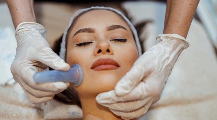 Facial cupping: Όλα όσα πρέπει να γνωρίζεις για το μασάζ προσώπου με βεντούζες