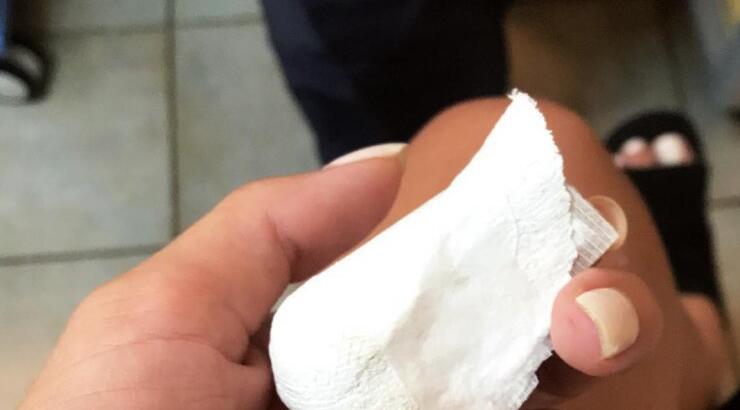 Επώνυμη Ελληνίδα έκανε πλαστική στη μύτη και μας δείχνει τη νέα της εικόνα!