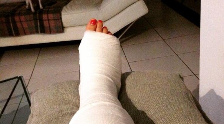 To κλάμα Κύπριας ηθοποιού για το κάταγμα του ποδιού της