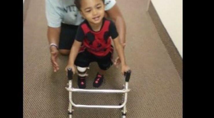 Δύναμη ψυχής! Το μικρό αγοράκι που κάνει τα πρώτα του βήματα με προσθετικό μέλος (βίντεο)  