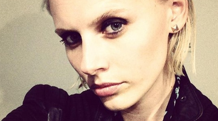 Απίστευτο: 24χρονο μοντέλο έχασε το πόδι του εξαιτίας ενός… ταμπόν!