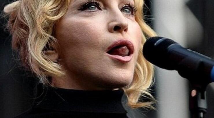 Madonna: Δείτε τον γιατρό που της έκανε όλες τις πλαστικές επεμβάσεις!