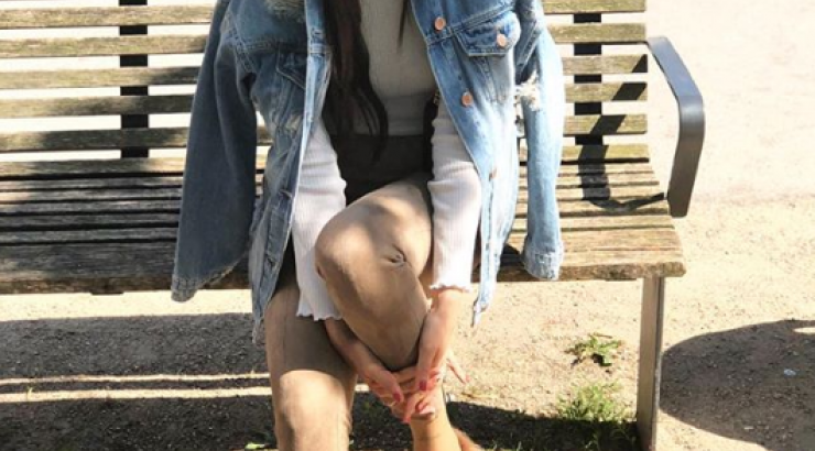 Wow! Η Μαρία Κορτζιά κάνει ηλιοθεραπεία και αναστατώνει με τα καλλίγραμμα της πόδια!