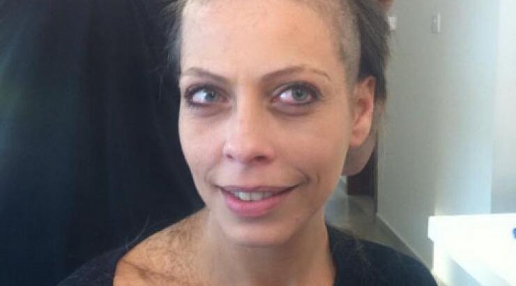 Η Μαρία Μιχαήλ με ξυρισμένο κεφάλι