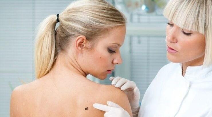 Ελιές σε πρόσωπο και σώμα! Τι να προσέξουμε; 