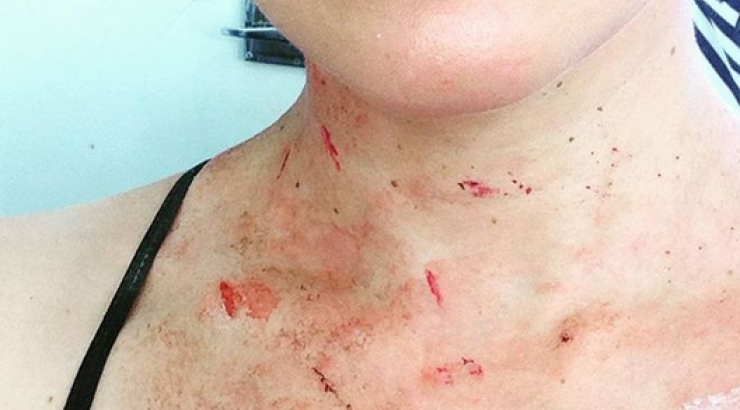 Δείτε τι έπαθε πασίγνωστη ηθοποιός!