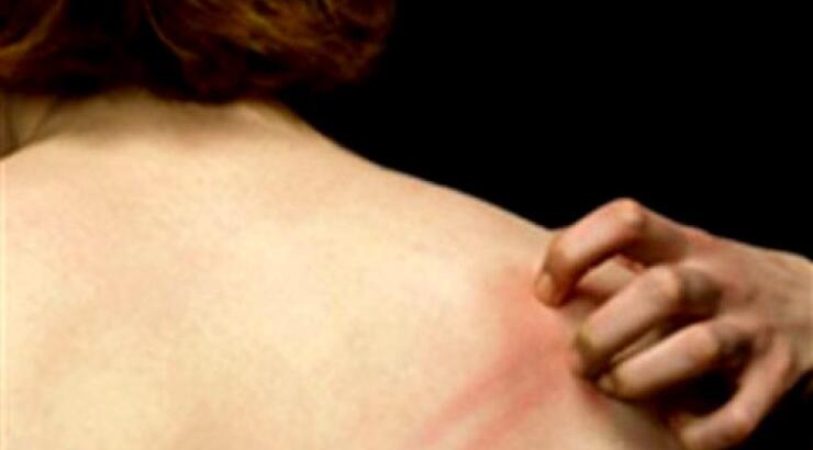 Άγχος και Δερματοπάθειες