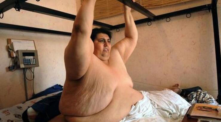  Πέθανε ο πιο παχύσαρκος άνθρωπος στον κόσμο που ζύγιζε 560 κιλά 