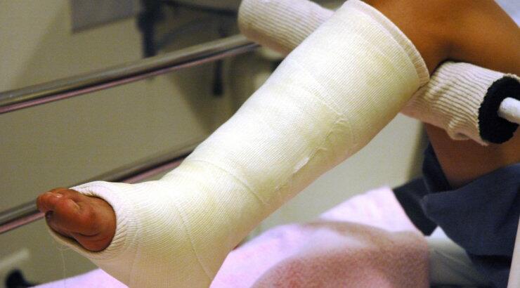 Γυναίκα με σπασμένο πόδι πέθανε περιμένοντας ορθοπεδικό