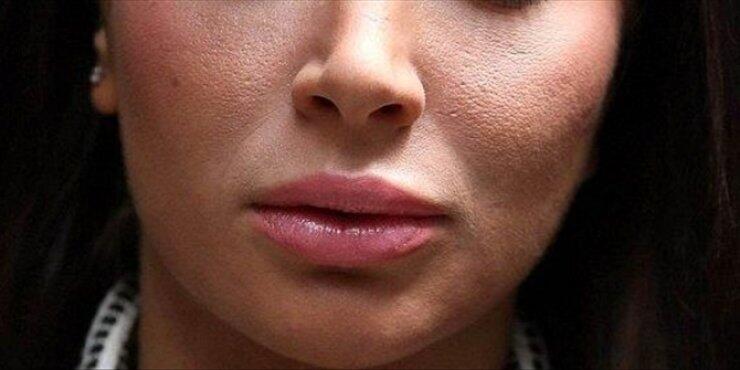 Ποια 25χρονη Ελληνίδα τραγουδίστρια έγινε άλλος άνθρωπος από τις πλαστικές;