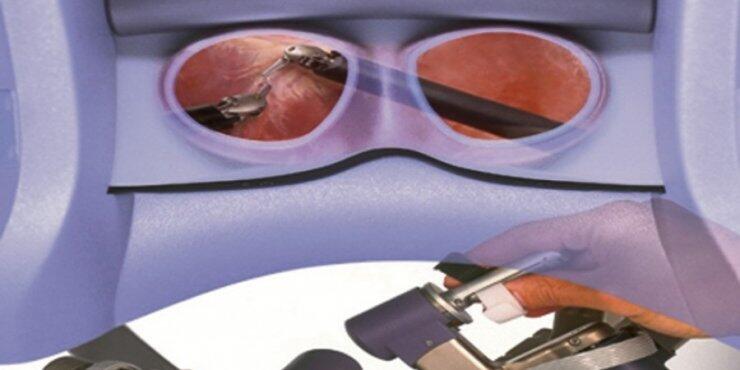 Επιδότηση προστατεκτομής Κυπρίων χωρίς ηλικιακά κριτήρια 