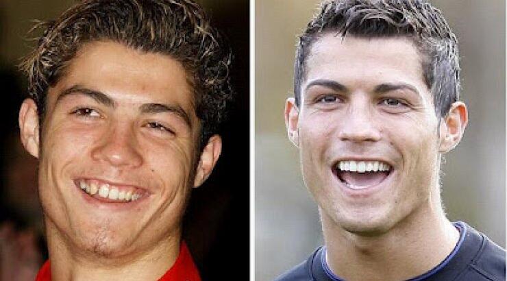 Κριστιάνο Ρονάλτο: Δείτε τον πριν και μετά τις πλαστικές