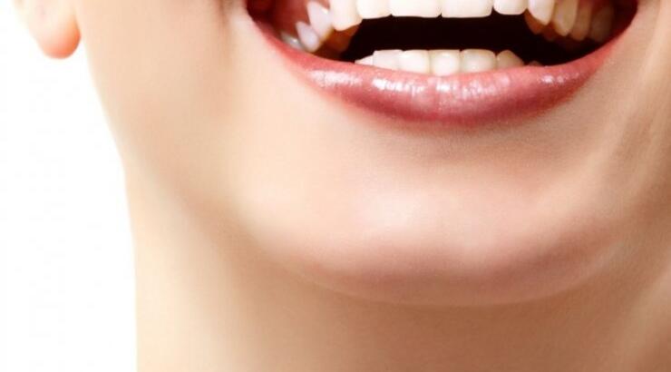 Όμορφο χαμόγελο και λεύκανση