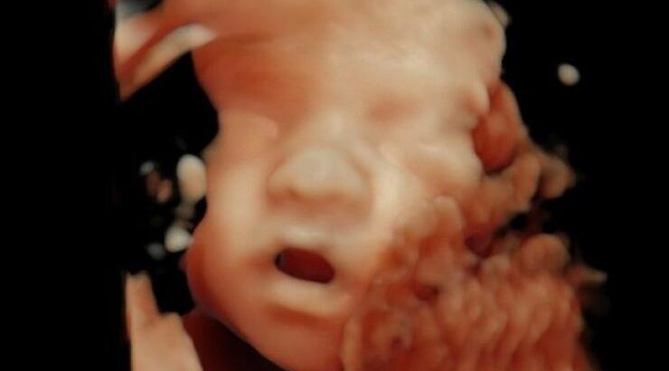 Άρχισαν οι αποκαλύψεις για τις επικείμενες γεννήσεις της showbiz