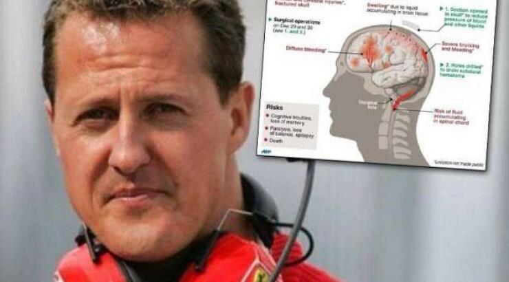 Άρχισε να αντιδρά ο Μίκαελ Σουμάχερ