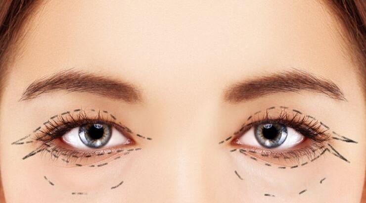 Όμορφα μάτια και βλεφαροπλαστική