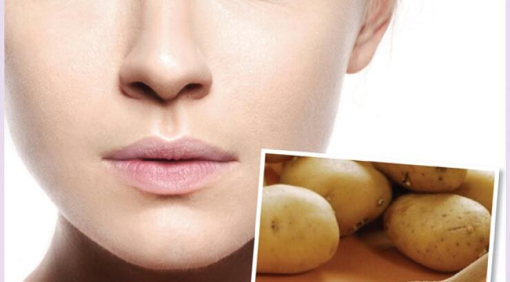 Φτιάξε μόνη σου κρέμα ματιών από πατάτα