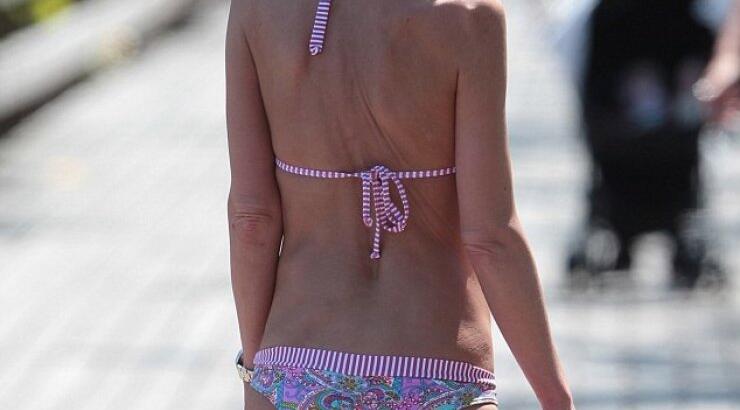 Η αδυνατισμένη εικόνα διάσημης ηθοποιού που προκαλεί αντιδράσεις