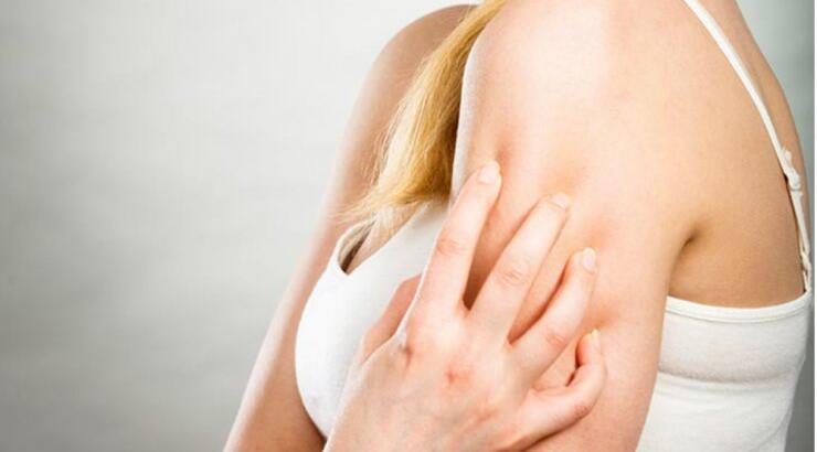 Τέσσερα πράγματα που πρέπει να κάνεις όταν σε τσιμπήσει κουνούπι