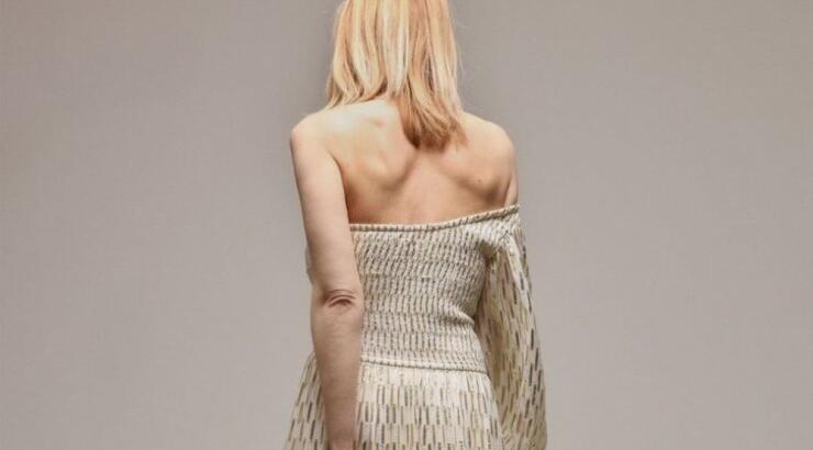 Γνωστή Ελληνίδα: "Αν πατήσεις αυτήν την στιγμή στην Google το όνομά μου θα σου βγει νευρική ανορεξία" [βίντεο]