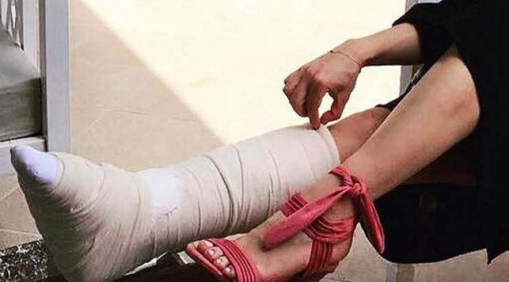 Στο γύψο το πόδι Κύπριας παρουσιάστριας! [εικόνες]