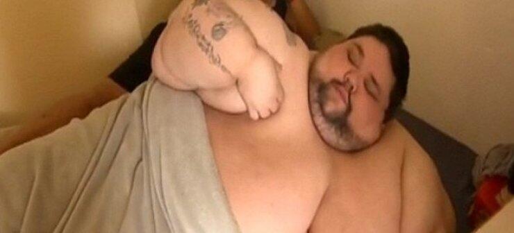  Η τραγική ιστορία του πιο χοντρού άνδρα στον κόσμο 