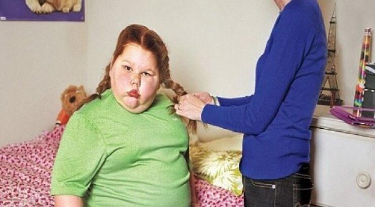 Είναι 12χρονη και παχαίνει χωρίς σταματημό