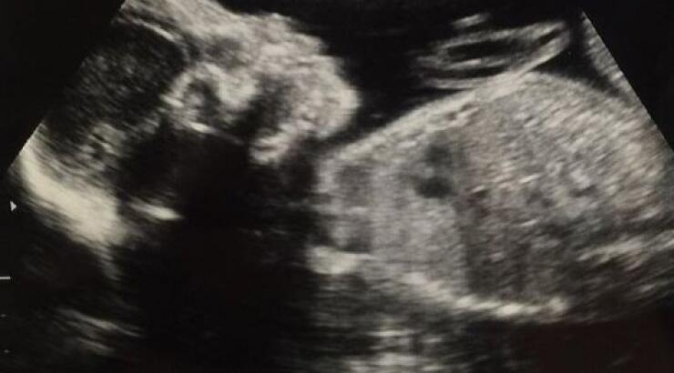 Έμαθαν το φύλο του μωρού τους και ανακοίνωσαν το όνομα μαζί με τον υπέρηχο