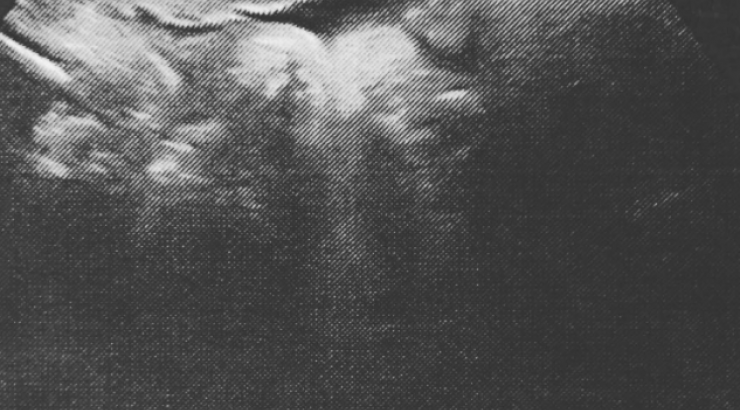 Πασίγνωστος ηθοποιός θα γίνει μπαμπάς για πρώτη φορά και μας δείχνει το υπερηχογράφημα!