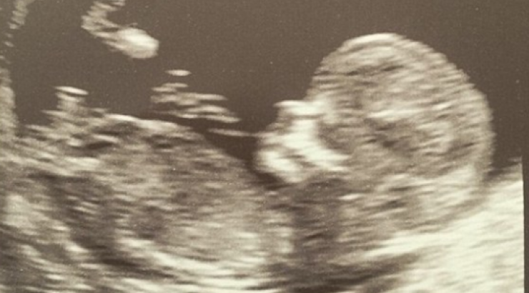 Πατέρας για τέταρτη φορά επώνυμος Κύπριος!