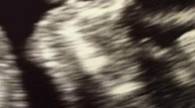 Ο πρώτος υπέρηχος του μωρού τους και το συγκινητικό μήνυμα στο instagram!