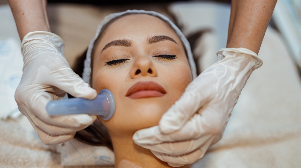 Facial cupping: Όλα όσα πρέπει να γνωρίζεις για το μασάζ προσώπου με βεντούζες