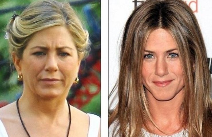 Απίστευτο! Πρήστηκε το πρόσωπο της Άνιστον!