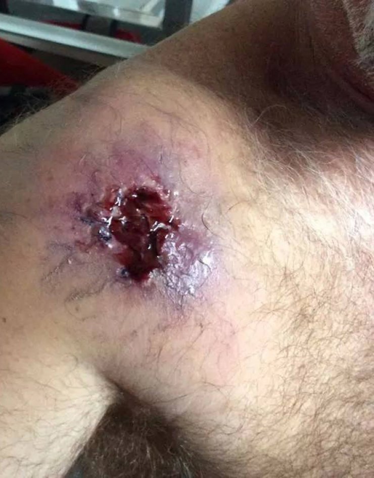 Το σοβαρό τραύμα ηθοποιού που συμμετέχει σε κυπριακή σειρά