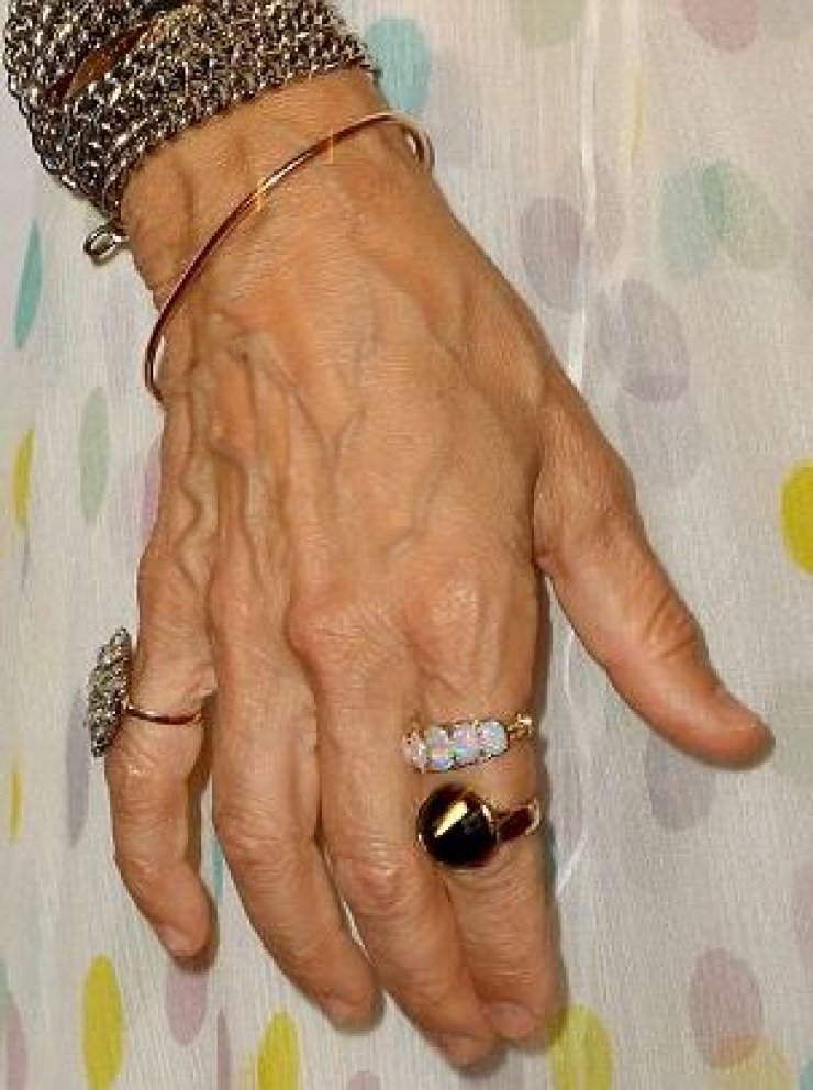 Σε ποια πασίγνωστη ηθοποιό ανήκουν αυτά τα γερασμένα χέρια;